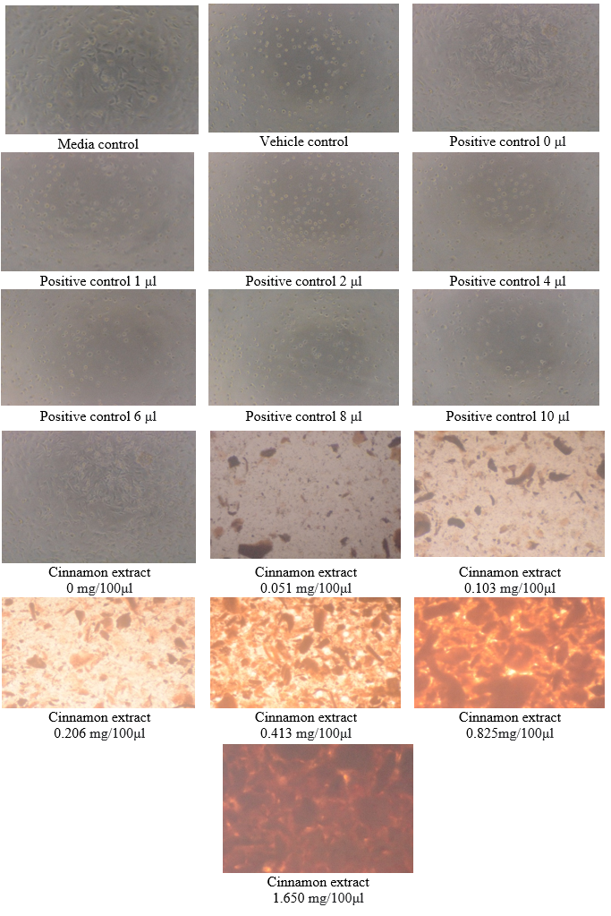 Behavior of U87-MG cells as seen under the microscope, after exposure to cinnamon extract 