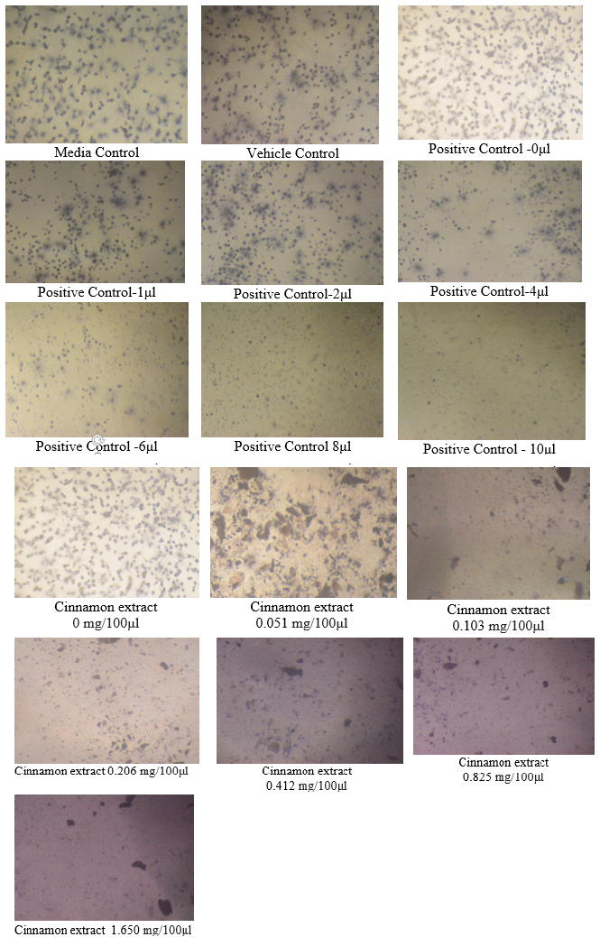 Behavior of U87-MG cells as seen under the microscope, after the addition of MTT