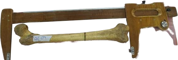 Measurement of total length of femur using osteometric board