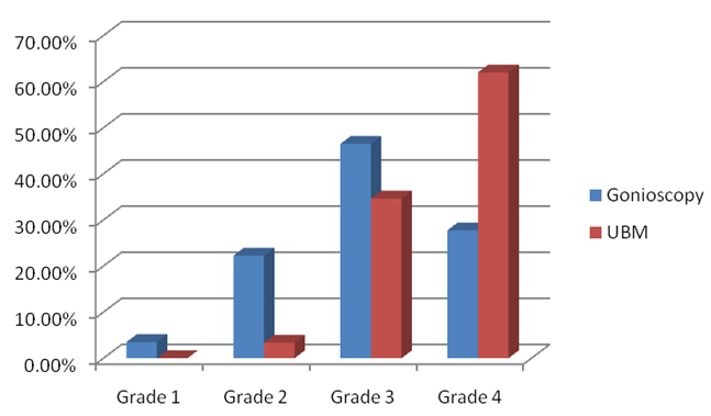 Comparision of angle grades of gonioscopy and UBM