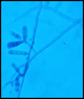 LCB mount of E. floccosum; E. floccosum showing clusters of club shaped macroconidia.(40X)