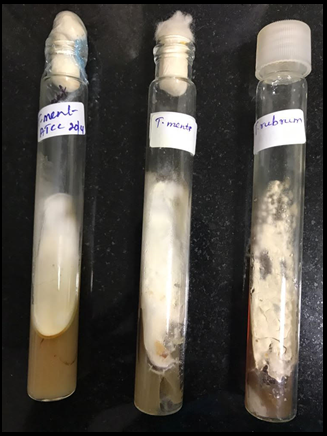 SDA tubes showing colonies of T. mentagrophytes, T. rubrum and ATCC T. mentagrophytes