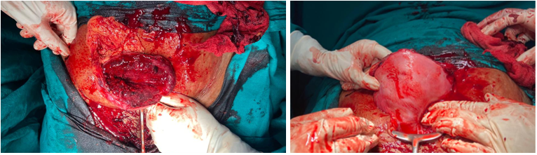 Shows picture of fundus taken from above and front