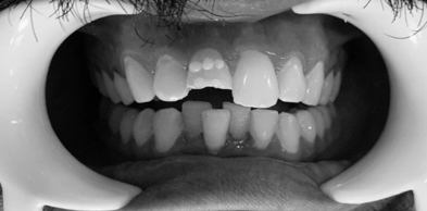 Black and White image