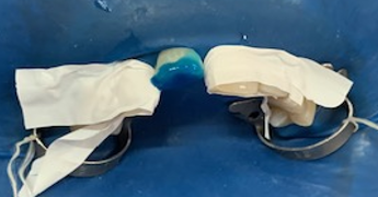 Isolation of adjacent teeth.