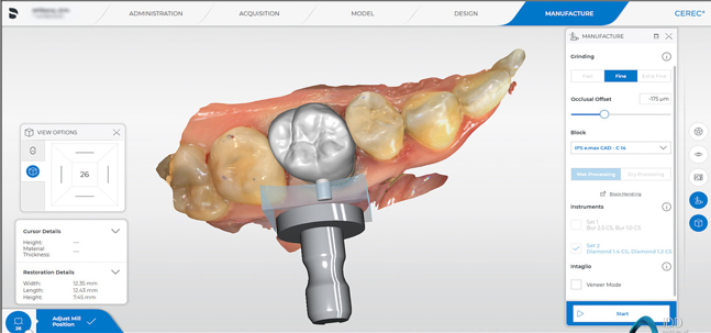 Five step protocol followed by CEREC Software