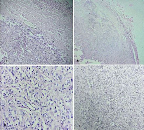 Microscopic examination (low magnification); A&B: A well encapsulated benign neoplastic tumour. (Haematoxylin and eosin stain; 4X and 10X respectively). Microscopic examination; C&D: Tumour composed of cells arranged predominantly in nests and trabeculae. (Haematoxylin and eosin stain; 10X and 20X, respectively)