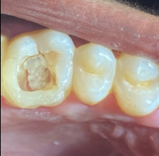 Pre-operative