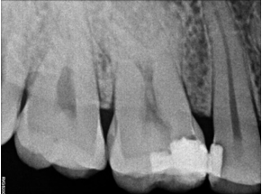 Pre-operative