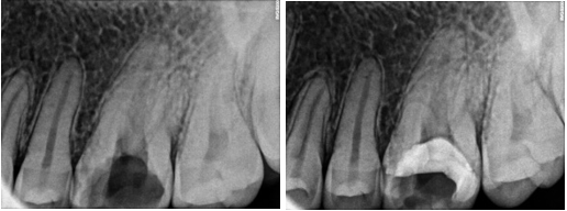 Pre-operative