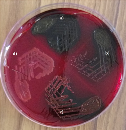 Congored agar method: a) Strong biofilm producer; b)Moderate biofilm producer; c) Weak biofilm producer; d) Non biofilm producer