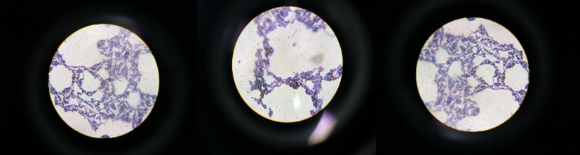 Gram positive bacteria