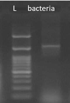 Agarose (1.5%) gel electrophoresis of PCR using 27F and 1492R primers bacterial sample. Legends: lad-Molecular Weight Marker- 100 bp Takara