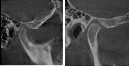 Pre treatment CBCT scan