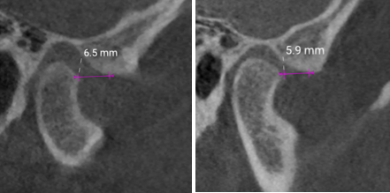 Current treatment CBCT scan