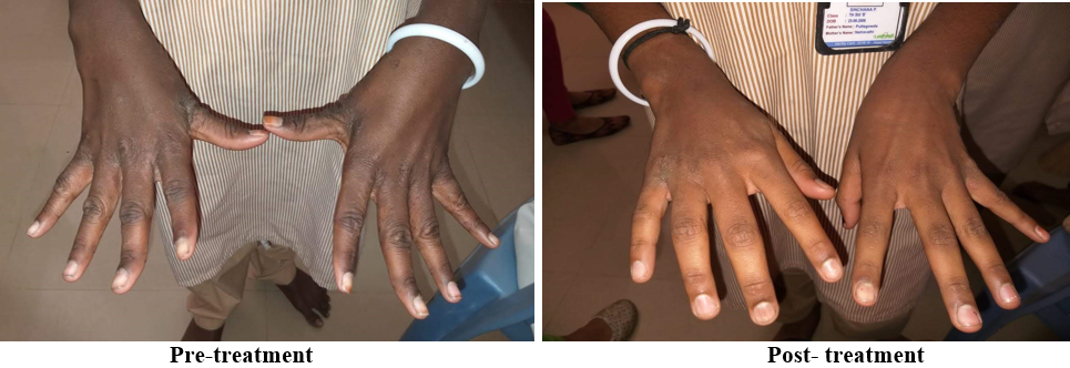 Group C patient treated with oral ivermectin