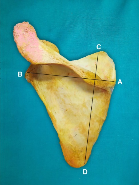 Showing various points on scapula taken for measurement; A, B: Maximum scapular breadth; C, D: Maximum scapular length