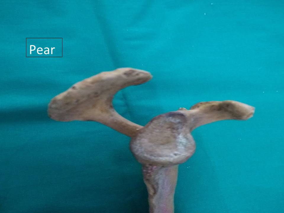 Showing pear shaped glenoid cavity