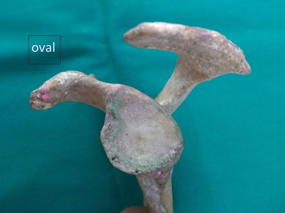 Showing oval shaped glenoid cavity