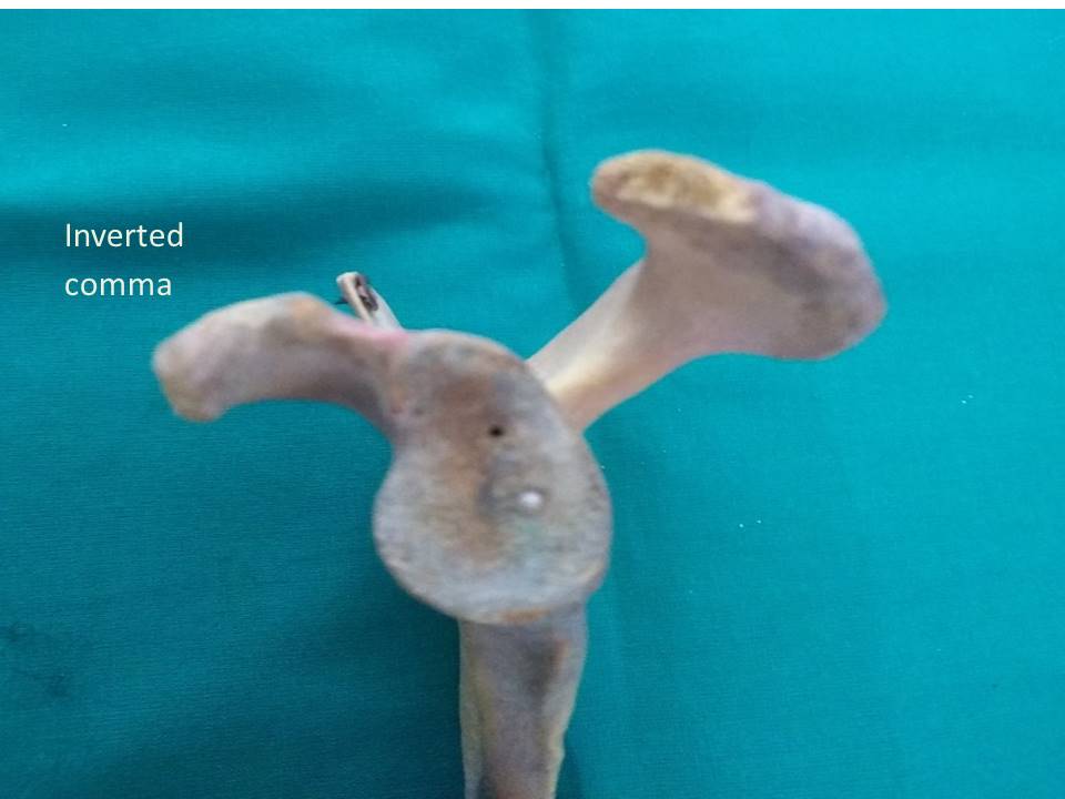 Showing inverted comma shaped glenoid cavity