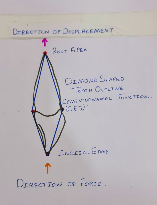 Sketch diagram showing the diamond shaped outline of the central incisor.