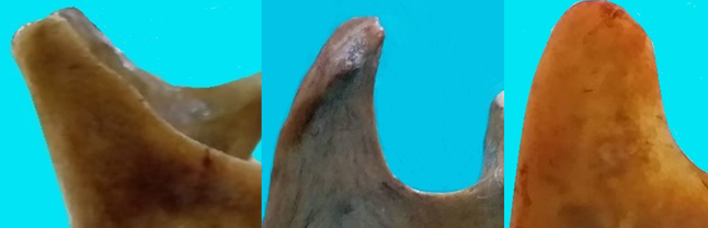 Showing the triangular, hook shaped and rounded coronoid processes (left to right)