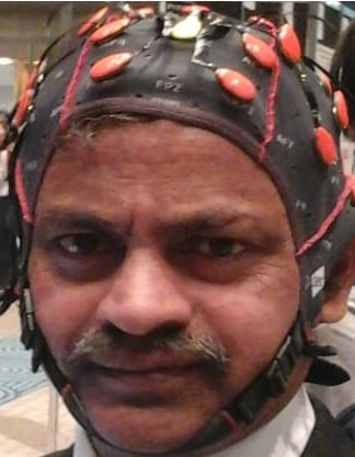 A wireless head worn electrode system
