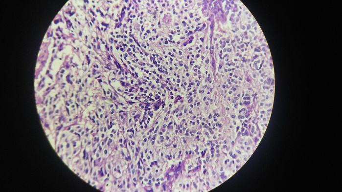 High power magnification