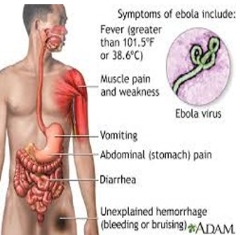 Symptoms of Ebola Virus