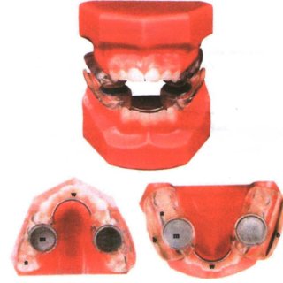 Active Vertical Corrector
