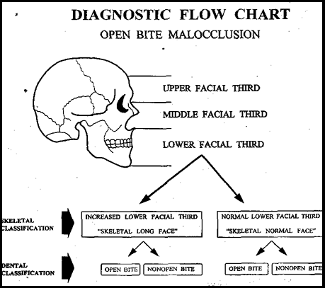Diagnostic flow chart for open bite malocclusion