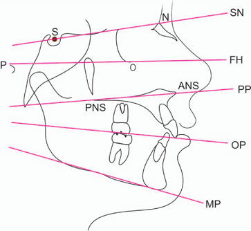 Planes referred forSassouni Analysis