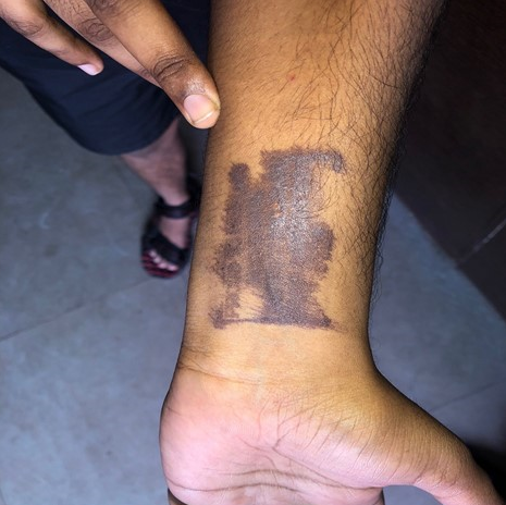 HOME QUARANTINE seal put on ventral aspect of forearm using indelible ink.