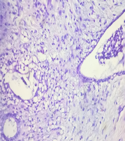 Endometrial glands lined by cuboidal cells and surrounding stroma.