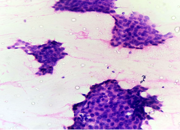H&E-Showing benign ductal epithelial cell cluster under 40x