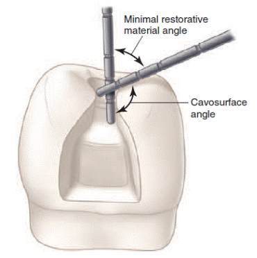 The cavosurface angle.