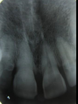 Preoperative radiograph