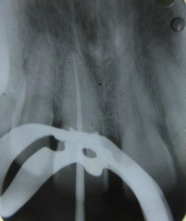 Master cone radiograph
