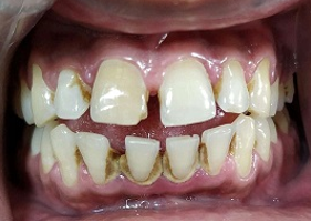 Preoperative clinical image 