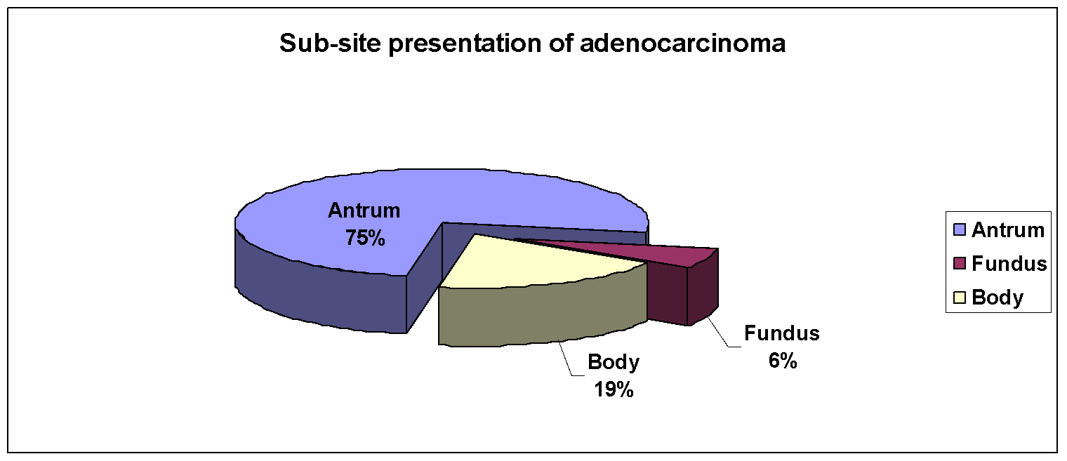 Sub-site of adenocarcinoma stomach