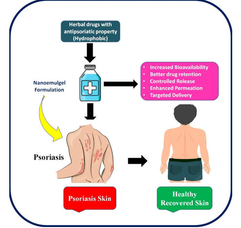 Diagrammatic representation showing applicability of emulgel formulation for phototherapy of Psoriasis 