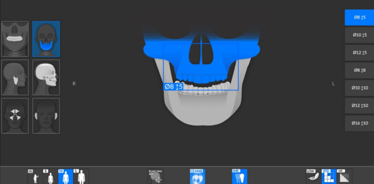 Different FOV can be selected as per requirement