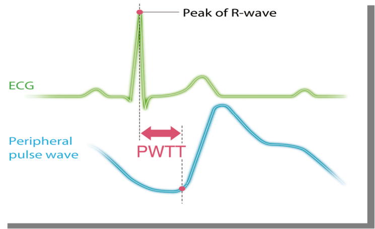 Estimated continuous cardiac output (esCCO) by PWTT