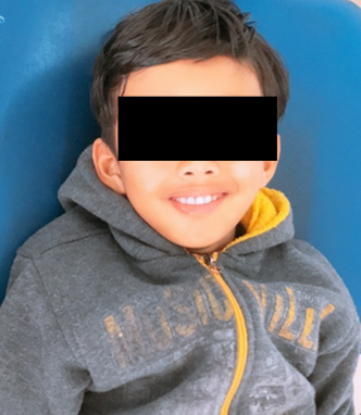 Facial view postoperatively