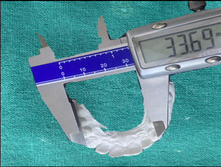 Manual measurement being made on a stone cast by a digitalvernier calliper.
