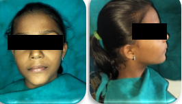 Pre – op extra oral profile