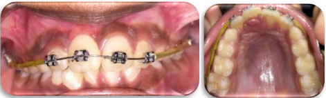 Follow up after 4 weeks