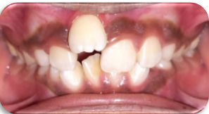 Frontal view