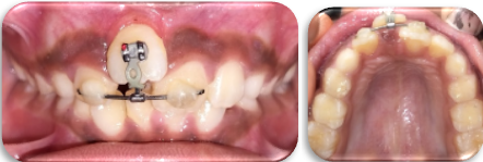 Follow up after 15 days