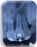 IOPAR w.r.t 11,21